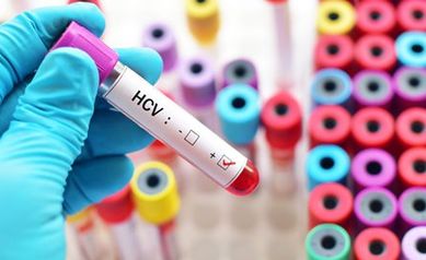 Hep-C