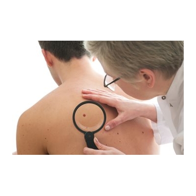 Skin Cancer: Are You at Risk?