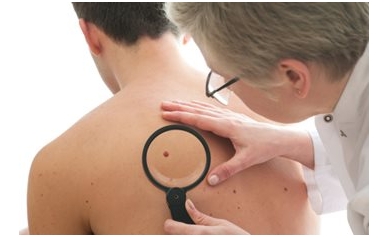 Skin Cancer: Are You at Risk?