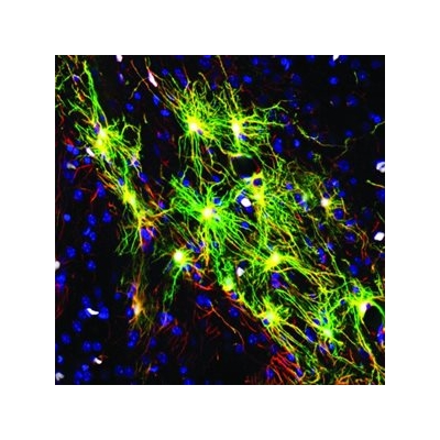 A New Powerful Platform to Study the Human Brain