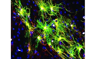 A New Powerful Platform to Study the Human Brain