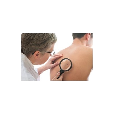 Tracking Melanoma Metastasis Leads to Key Gene Discovery
