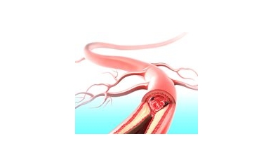 UR, Cornell Team Up to Study Inflammation
