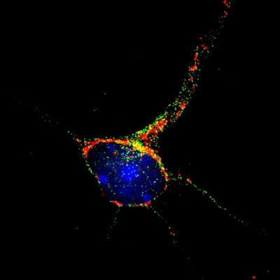 Researchers Pinpoint Gene Central to Brain Degeneration