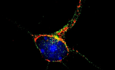 Researchers Pinpoint Gene Central to Brain Degeneration