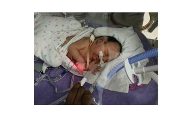 Baby Girl Overcomes Multiple Medical Obstacles