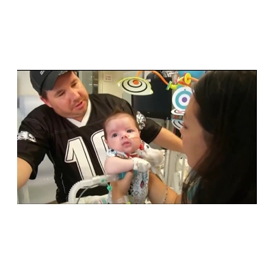 Horseheads baby suffers rare condition