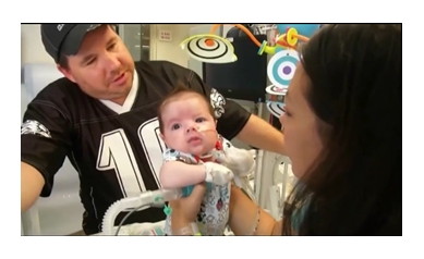 Horseheads baby suffers rare condition