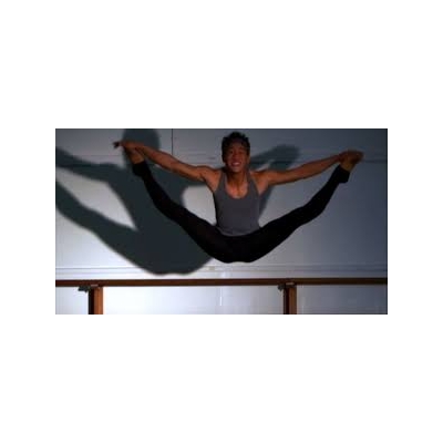 Former Eastman Dental Patient A  Finalist on So You Think You Can Dance?