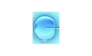 Female Fertility: What’s Testosterone Got To Do With It?