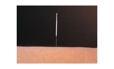 Acupuncture’s Molecular Effects Pinned Down