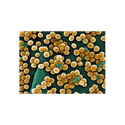 UR, Monroe County Help Paint National Picture of Falling MRSA Rates