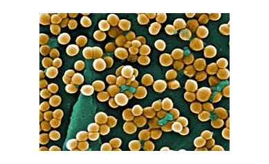 UR, Monroe County Help Paint National Picture of Falling MRSA Rates