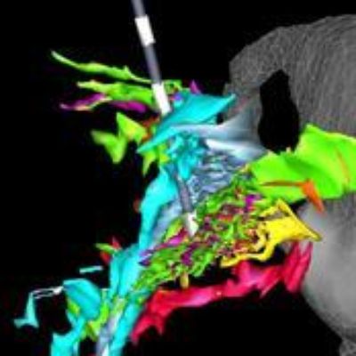 Neuroscience Symposia Highlight Brain Research, Relevance for Patients