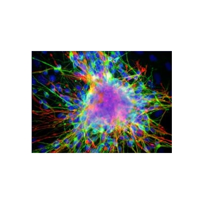 Stem Cell Advance a Step Forward for Treatment of Brain Diseases