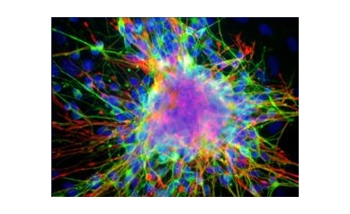 Stem Cell Advance a Step Forward for Treatment of Brain Diseases