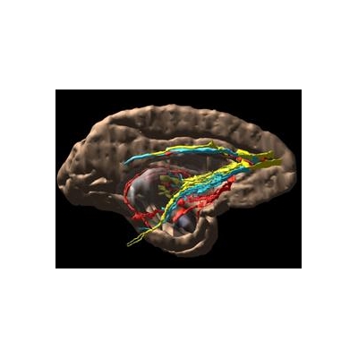 Award to Neuroscientist Boosts Mental Health Research