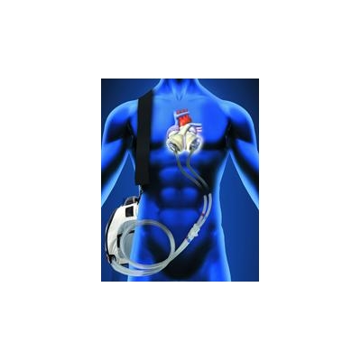 URMC Surgeons Implant 1st Total Artificial Heart in Upstate New York
