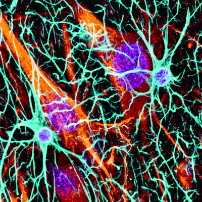 ASTROCYTES_2-med