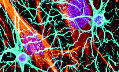 New Funding Boosts URMC Biotech Start-Up for Neurological Disorders