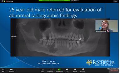 OMFS International Grand Rounds a First at URMC