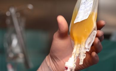 Transfusion of human plasma.