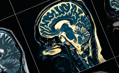 Copper Identified as Culprit in Alzheimer’s Disease