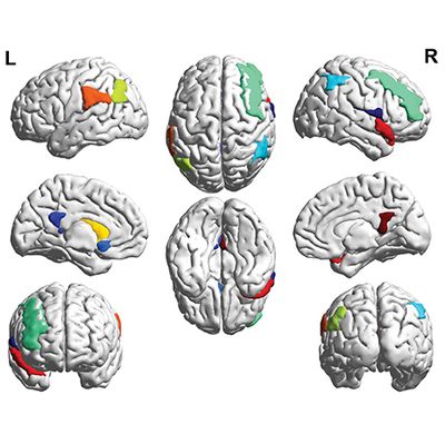 Using Machine Learning to Diagnose HIV-associated Neurocognitive Disorders