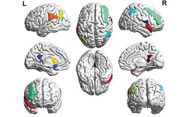 Using Machine Learning to Diagnose HIV-associated Neurocognitive Disorders