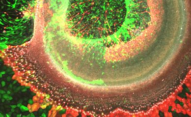 Study Points to Possible New Therapy for Hearing Loss