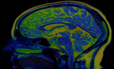 Anxiety cues found in the brain despite safe environment