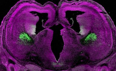 Del Monte Institute for Neuroscience pilot grant program makes institute history