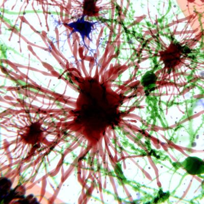 astrocytes getty