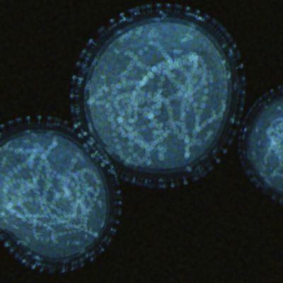 Monkeypox Virus
