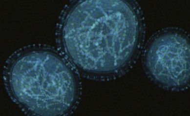 Monkeypox Virus