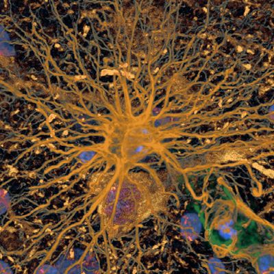 astrocyte2