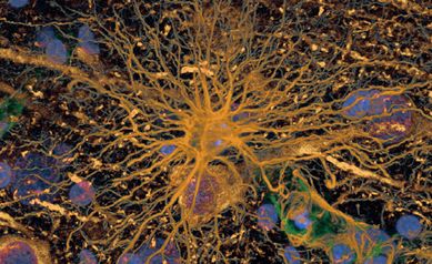 astrocyte2