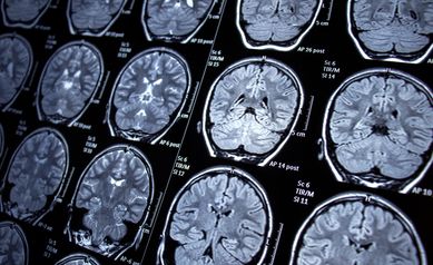 brain scans