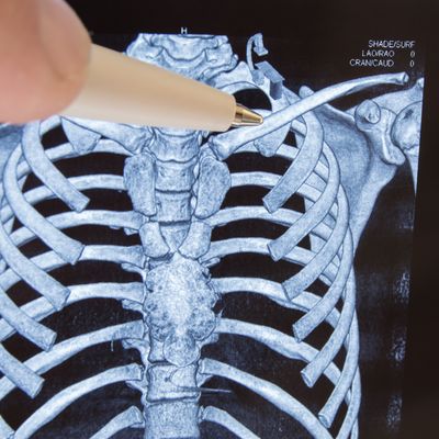 CT Scan