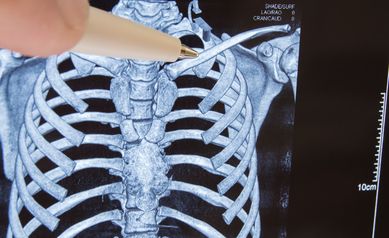 CT Scan