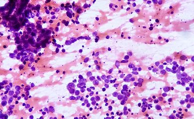 lab-profile-Rappold Lab -- renal cell carcinoma