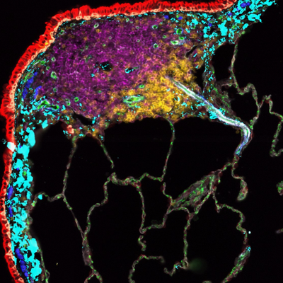 Lung Image 1