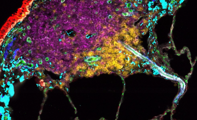 Lung Image 1