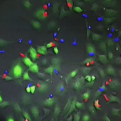 T Cells attacking tumors