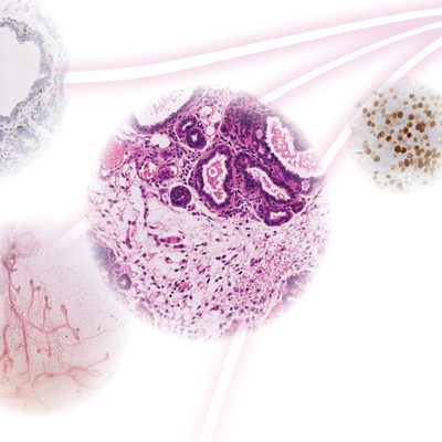 Guided by Research, Wilmot’s Breast Cancer Program Comes of Age