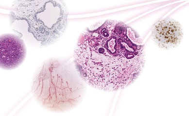 Guided by Research, Wilmot’s Breast Cancer Program Comes of Age