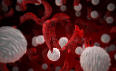 Sickle Cell Image