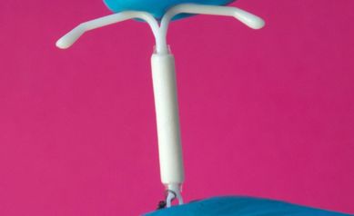 The ABCs of IUDs: What to Expect with Intrauterine Device (IUD) Insertion, Use, and Removal
