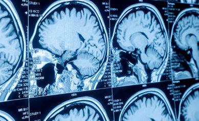 Researchers Uncover Possible New Biomarker for Psychosis Diagnosis