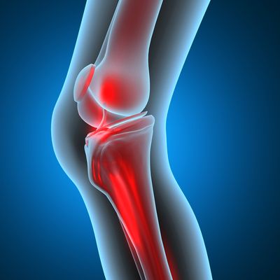 Protein Provides Clues to Identifying and Treating Crippling, Costly Bone Infections
